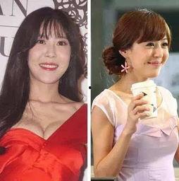 明星整形吃瓜,揭秘娱乐圈“变脸”背后的秘密